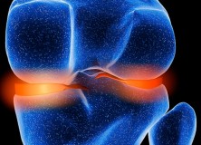 Glucosammina & condroitina: contro i dolori articolari